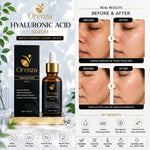 Hyaluronic Acid Serum
