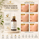 Niacinamide + Zinc Serum